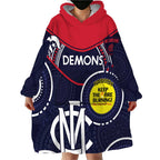 Custom AFL Demons NAIDOC Week Wearable Blanket Hoodie Keep The Fire Burning Indigenous Art
